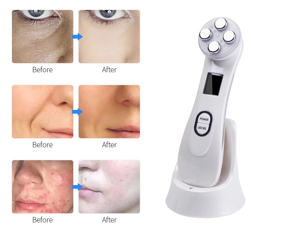 EMS Micro-current Facial Skin Firm Massager-– Lift, Sculpt, and Glow!